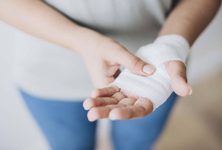 Common Hand Injuries From Auto Accidents & How To Treat Them