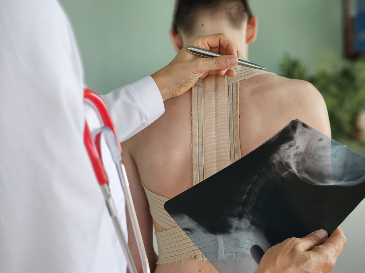 Provider reviewing spine X-ray with patient during pain management evaluation after auto accident